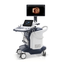 Sonoscape S60 3d 4d Machine à ultrasons haut de gamme Couleur Doppler Intelligent Wis + Trolley Diagnostic Système à ultrasons