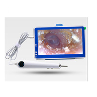 HD 720p Digital Microscope Medical Home Ear Nasal Cleaner ENT Otoscope Camera Visual Endoscope 7 Inch LCD
