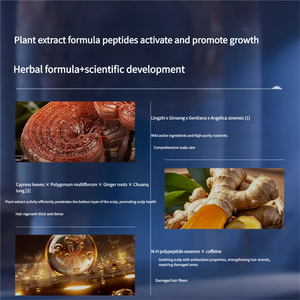 Bulk for Private Label Best Organic <strong>Neo</strong> <strong>Hair</strong> Growth <strong>Oil</strong> - Product Image 4