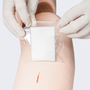 Conformable Transparent IV Dressing 6x7cm Sterile Adhesive Film with U-Notch for <strong>Pediatric</strong> and Adult Peripheral IV Cannula Use - Product Image 6