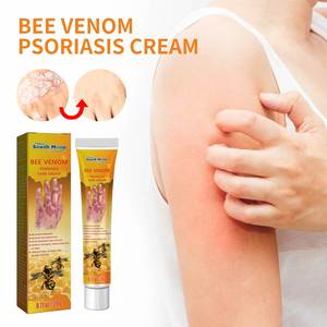 Krim <span class=keywords><strong>Psoriasis</strong></span>, krim kulit infeksi jamur 20G salep Dermatitis Eczema perawatan <span class=keywords><strong>Psoriasis</strong></span> - Product Image 5