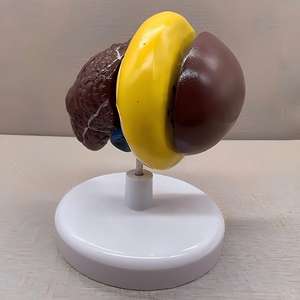 แบบจำลองการสอนเกี่ยวกับมะเร็งตับพร้อมฐาน - เครื่องมือกายวิภาคที่ถอดออกได้สำหรับการศึกษาโรคตับ - Product Image 5