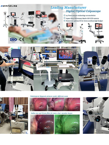 Colposcopio Digital Portátil de Video Óptico CMOS para Ginecología, Modelo Kernel Kn2200b, para Cérvix, Vulva y Vagina - Product Image 4
