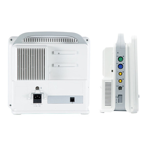 Monitor Multiparamétrico Veterinario Portátil de Alta Calidad VM12, Pantalla Táctil de 12.1 Pulgadas, Fuente de Alimentación Eléctrica - Product Image 6