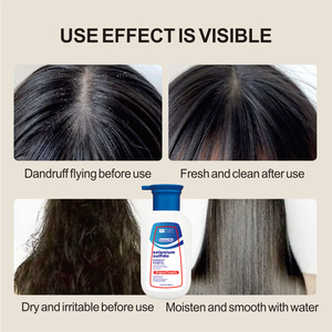 Sampo Anti ketombe 500ml minyak Argan <span class=keywords><strong>Selenium</strong></span> sulfida 5In1 sampo pembersih kulit kepala dalam aroma ringan melembapkan - Product Image 6