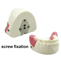 Modelo de Práctica para Extracción de Dientes Impactados, Modelo Oral Simulado con Diente Impactado Removible y Base Desmontable