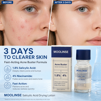 Traitement liquide anti-acné à l'acide salicylique, personnalisé OEM, très vendu à l'international, avec Quaternium-73 et Niacinamide pour éliminer les boutons et les imperfections.