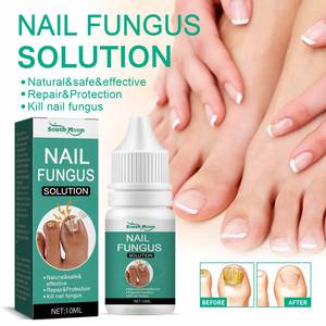 Traitement antifongique pour les ongles à base de plantes South Moon 10 ml, soin des pieds, réparation des pieds, liquide réparateur antifongique pour les ongles - Product Image 4