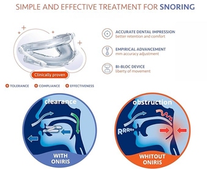 Dispositif anti-ronflement 2026 à avancement <span class=keywords><strong>mandibulaire</strong></span> – Protège-dents réglable sans BPA avec technologie de sommeil silencieux - Product Image 2