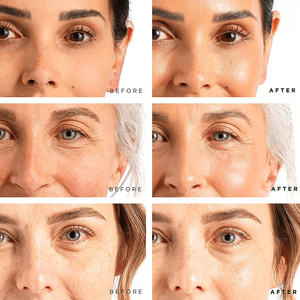 Private Label Face Serum Natural Skin Care siero alla <span class=keywords><strong>vitamina</strong></span> <span class=keywords><strong>C</strong></span> siero viso sbiancante antietà per schiarire la <span class=keywords><strong>pelle</strong></span> - Product Image 5