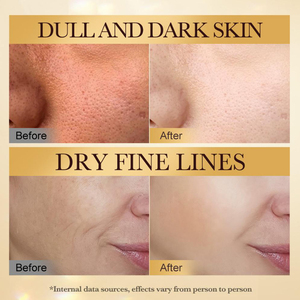 Set de Cuidado Facial de Marca Blanca con Veneno de Abeja Natural, Péptidos Hidratantes, Antienvejecimiento, Reafirmante y Eliminador de Arrugas - Product Image 5