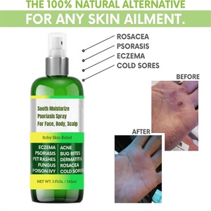 Eczema-tratamiento <span class=keywords><strong>para</strong></span> la Psoriasis, antipicazón espray hidratante <span class=keywords><strong>para</strong></span> el acné, <span class=keywords><strong>Dermatitis</strong></span>, sacea, alivio del cuero cabelludo <span class=keywords><strong>para</strong></span> niños y adultos - Product Image 4