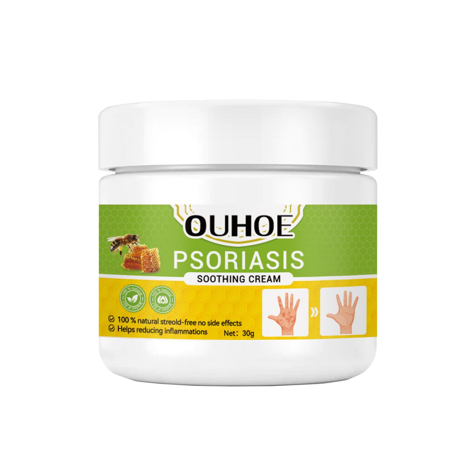 OUHOE Venta al por mayor Infección por hongos Psoriasis DE LA PIEL Cremas calmantes Dermatitis Eczema Pomada Tratamiento Psoriasis Crema para la piel