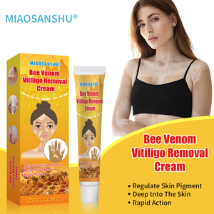 OEM Crème de soin pour le corps en plâtre chinois au venin d'abeille et au <span class=keywords><strong>vitiligo</strong></span> pour les mains et les pieds, complément pour les soins de la peau - Product Image 2