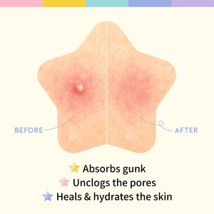 T Hydrocolloid Parches para el acné con ácido salicílico Cute Star Zit Stickers Colorful Star Blemish Covers para Face Zit Patch Acné Dots - Product Image 5
