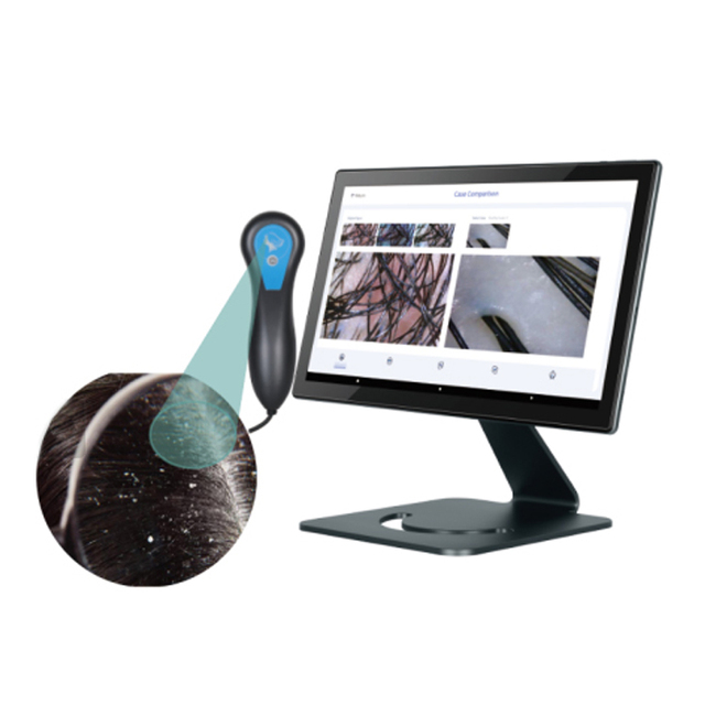 Portable 200x HD AI Smart Scalp Analyzer, Printable Analysis Reports, 360° Adjustable Angle, 14.1-inch Touchscreen.