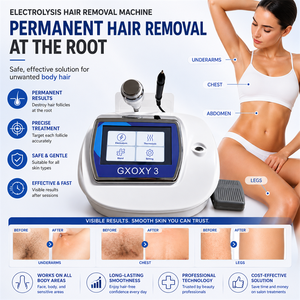 Appareil d'épilation permanente indolore ZS Home Salon, épilateur à électrolyse pour hommes, femmes, visage, corps, bikini - Product Image 1