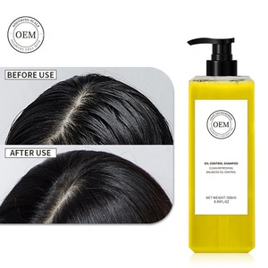 Commercio all'ingrosso Shampoo per capelli all'ingrosso professionale Shampoing Pour Cheveux olio di controllo OEM prodotti per capelli per cuoio capelluto oleoso - Product Image 1