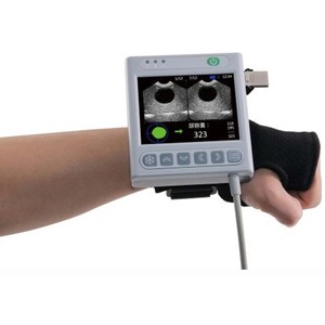 Escáner de Vejiga Inalámbrico Portátil Visbull BVT-02 con Certificación CE, Diseño Digital de Mano de Fácil Operación para Uso Clínico - Product Image 5