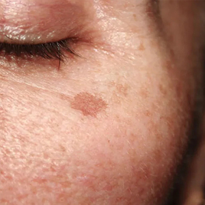 Crème raffermissante de luxe pour le visage à l'Alpinia Galanga, crème liftante pour le cou pour remodeler la silhouette en V - Product Image 3