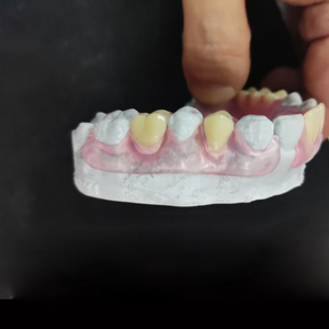 Lab odontoiatrico miglior prezzo prodotti personalizzati rimovibili protesi flessibili rosa <span class=keywords><strong>Valplast</strong></span> con Base Tcs denti acrilici buon Design - Product Image 6