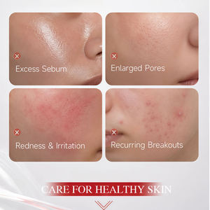 Cuidado Facial con Extracto de Hoja de Camelia Sinensis de 75 ml de Marca Privada para Mujeres, Calmante, Equilibrante y Control de Sebo, Fabricante OEM/ODM - Product Image 3