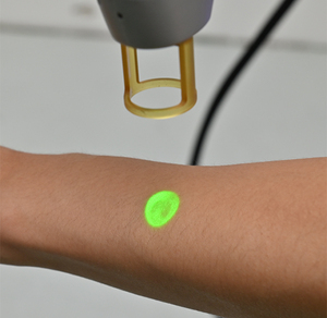 เครื่องเลเซอร์ <span class=keywords><strong>YAG</strong></span> & Alexandrite อ่อนโยน1064nm เครื่องกำจัดหลอดเลือดชีพจรยาว755nm กำจัดขน - Product Image 5