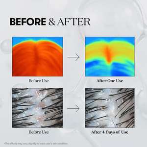 Ampolla Capilar PDRN de Marca Privada para el Cuidado del Cuero Cabelludo con Suero de ADN de Salmón PDRN para Reparación y Cuidado Hidratante del Cabello y Cuero Cabelludo - Product Image 4