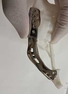 Mandíbula de Titanio de Excelente Calidad, Hecha a Medida, Alta Resistencia, Estructura de Mandíbula Precisa y Duradera, Disponible al Mejor Precio - Product Image 2