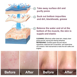 Crème éclaircissante pour la peau au thé vert Masque visage et corps Stick Masque nettoyant purifiant pour le nez et les mains - Product Image 3