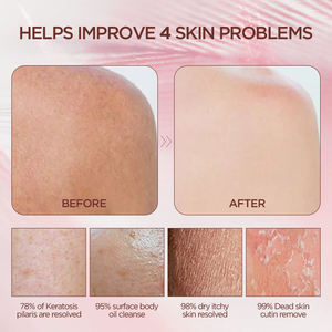 Guante de baño exfoliante de seda cruda 100%, guantes de baño de seda, guante de baño turco Exfoliante para evitar pelos encarnados, guantes Exfoliantes corporales - Product Image 2