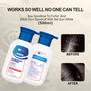 1% <span class=keywords><strong>Shampoo</strong></span> per capelli con solfuro di selenio 500ml trattamento del <span class=keywords><strong>cuoio</strong></span> <span class=keywords><strong>capelluto</strong></span> antiforfora benefici Anti-prurito per la <span class=keywords><strong>dermatite</strong></span> seborroica - Product Image 3