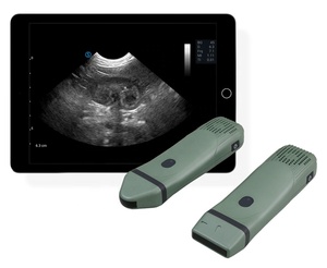 SIUI VP2 Phased/ Linear/Convex Handheld Veterinary Ultrasound Scanner and Portable Color Doppler Veterinary Imaging System - Product Image 1