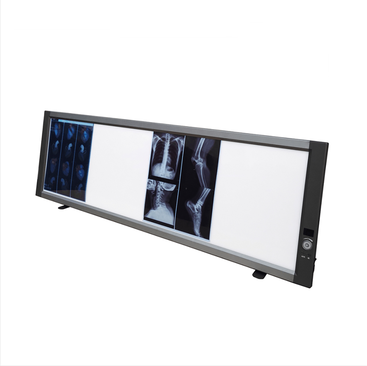 Visor de películas de rayos X LED médico ajustable Cuádruple visión de caja de visualización de películas de rayos X