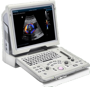 Sistema de Diagnóstico por Ultrasonido Doppler Color Portátil Mindray Z5, Adecuado para Aplicaciones Abdominales y Obstétricas/Ginecológicas. - Product Image 2