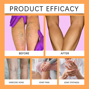 Crema de Alta Calidad para el Cuidado de las Venas de las Piernas con Veneno de Abeja y Vitamina E, 30g, Efecto Visible, Uso Femenino - Product Image 4