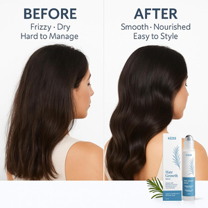 Siero per la Crescita dei Capelli 2-IN-1 con Rosmarino, Biotina e Saw Palmetto, Nutriente e Rinfrescante, ad Assorbimento Rapido - Product Image 4