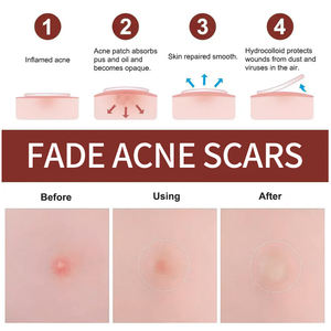 Patch anti-acné étoile coloré à marque privée avec Aloe Vera & Collagène, hydratant à la Vitamine C, hydrocolloïde imperméable - Product Image 4