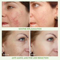 Produits de beauté coréens OEM pour une peau de verre, réduction des rides, hydratation intense, Amla, soin anti-âge du visage, crème