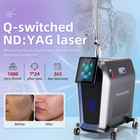 Nouvelle machine laser picoseconde à usage commercial 1064nm 755nm 532nm 650nm Q-Switched Nd YAG pour l'élimination des tatouages avec refroidissement par air