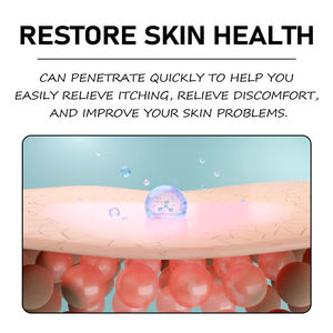 SmmlpunEczema, зуд кожи, стригущий лишай, сырость и токсины, местная Антибактериальная мазь - Product Image 4