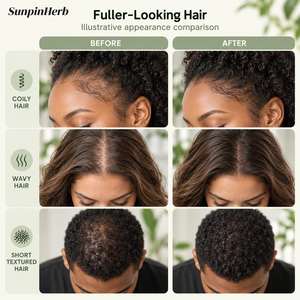 SUNPINHERB 5 Biotin Hair Growth <b>Serum</b> <b>Scalp</b> Nourishing Drop Rosemary Collagen Ginseng Wholesale OEM Factory 60ml - Product Image 6