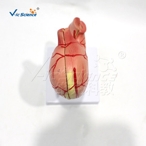 VIC-D021B Modelo de Estómago Natural Grande de 2 Componentes: Modelo de Enseñanza de Úlcera Gástrica Humana, Modelo de Enseñanza Patológica - Product Image 2
