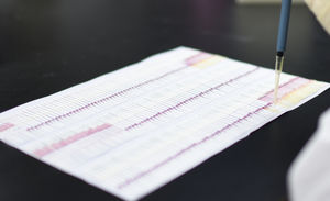 아프리카 돼지 열병 바이러스 항원 (ASFV Ag) 신속 테스트 장치 (에멀젼 방법) - Product Image 3