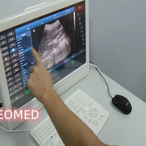 Échographe vétérinaire portable à écran tactile noir et blanc, transducteurs sonars, modèle BW08vet, le plus vendu à prix abordable - Product Image 3