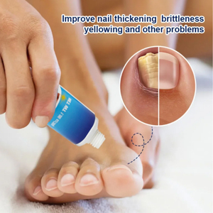 Crema ZB 30g per Micosi delle Unghie, Riparazione e Cura dei Piedi, Rimozione Funghi delle Unghie dei Piedi, Unguento per Onicomicosi - Product Image 3