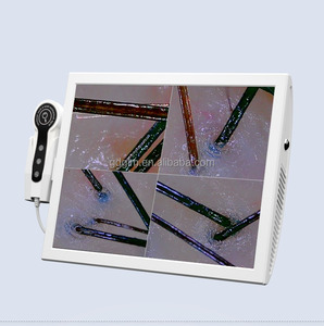 Analizzatore del Cuoio Capelluto di Grado Professionale da 15 Pollici, Scanner per Follicoli Capillari per Cliniche di Cura dei Capelli - Product Image 1