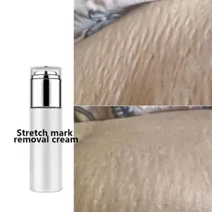 Customized Logo Scar Treatment Gel Anti Stretch Mark Cream Treatment For Stretch Marks Factory Supplier