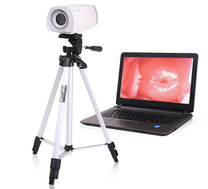 Colposcopio Ginecológico Médico HD, Sistema <span class=keywords><strong>de</strong></span> Videocolposcopia Portátil para Diagnóstico Cervical, Cirugía Clínica, Colposcopio Electrónico - Product Image 4