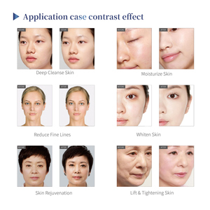 Máquina <span class=keywords><strong>Facial</strong></span> Reskin Pro Vertical 6 en 1 Multifunción para Rejuvenecimiento de la Piel, Blanqueamiento, Tensado, Hidrodermoabrasión - Product Image 6